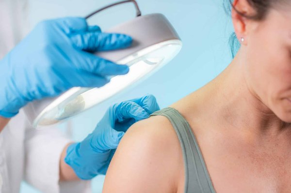 Comment réagir face à une urgence dermatologique ?